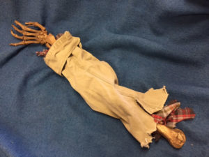 80. Roger’s Skeletal Arm